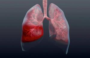Photo of Пневмония без кашля и температуры: как распознать опасное заболевание у ребенка